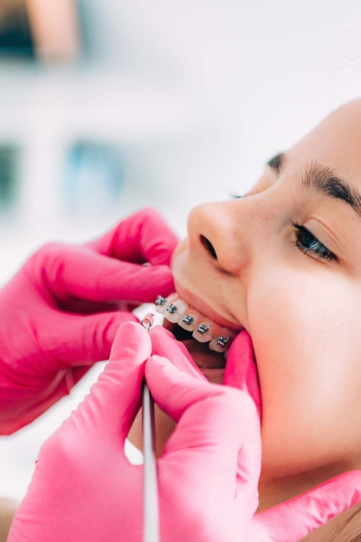 All about orthodontic treatment